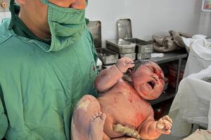 Bé gái cân nặng 6,2 KG vừa chào đời tại Bệnh viện Đa khoa tỉnh Bắc Giang